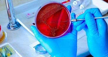 Microbiology